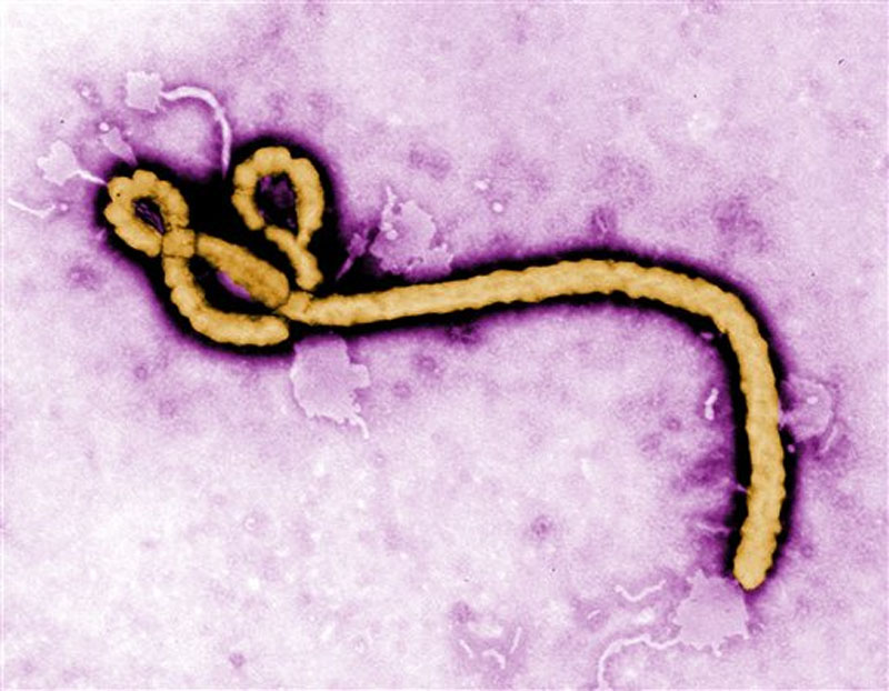 Colorised transmission electron micrograph file image made available by the CDC shows an Ebola virus virion. Graphic: AP