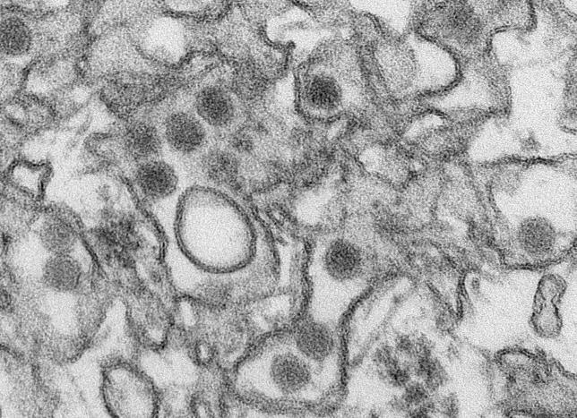 A transmission electron micrograph (TEM) shows the Zika virus, in an undated photo provided by the Centers For Disease Control in Atlanta, Georgia. REUTERS/CDC/Cynthia Goldsmith/Handout via Reuters