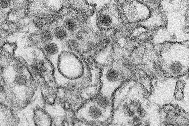 A transmission electron micrograph (TEM) shows the Zika virus, in an undated photo provided by the Centers For Disease Control in Atlanta, Georgia. Photo: Cynthia Goldsmith via Reuters