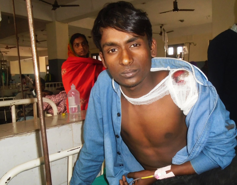 Deepak Thakur (17) injured in a shooting at the Rajbiraj-based Gajendra Narayan Singh Sagarmatha Zonal Hospital in Saptari on Friday, January 8, 2016. Photo: THT Online