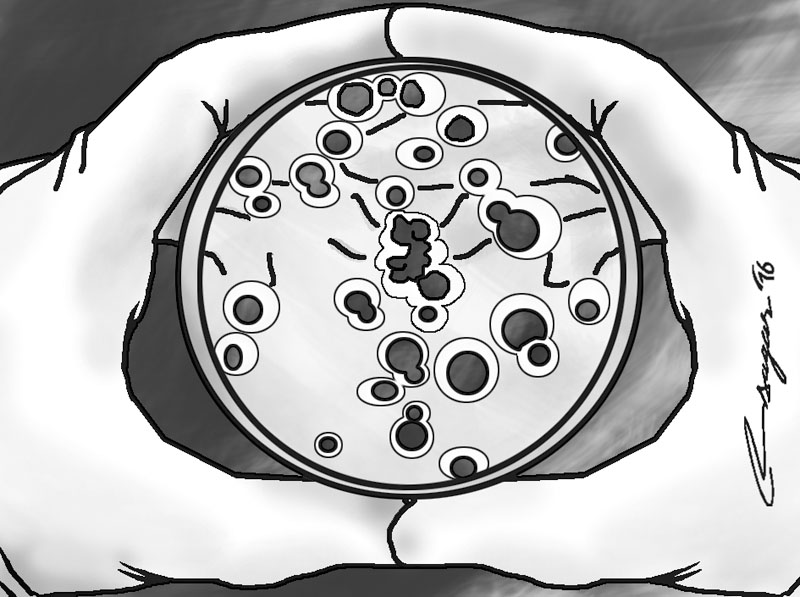 Bacteria. Illustration: Ratna Sagar Shrestha/THT