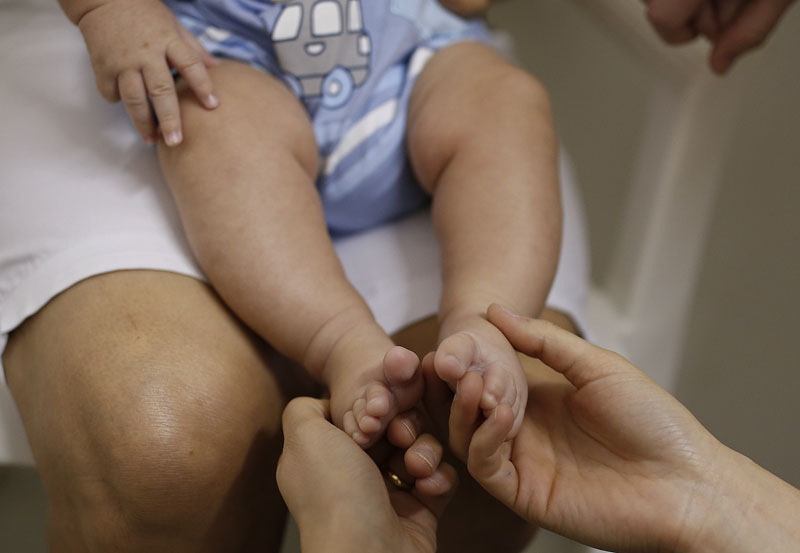 A health worker gives foot massage to 3-month-old Pedro Henrique in a hospital in Joao Pessoa, Brazil, on Wednesday, February 24, 2016, during an examination that's part of a study to determine if the Zika virus is causing babies to be born with a birth defect affecting the brain. Photo: AP