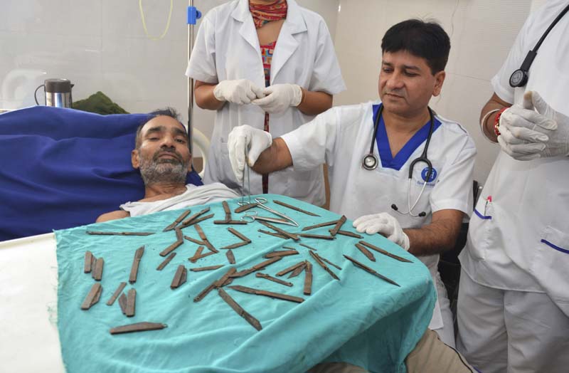 Jatinder Malhotra (R) displays 40 knives that were surgically removed from the stomach of police constable Surjeet Singh, as he recuperates in a hospital in Amritsar, India, on Tuesday, August 23, 2016. Photo: AP