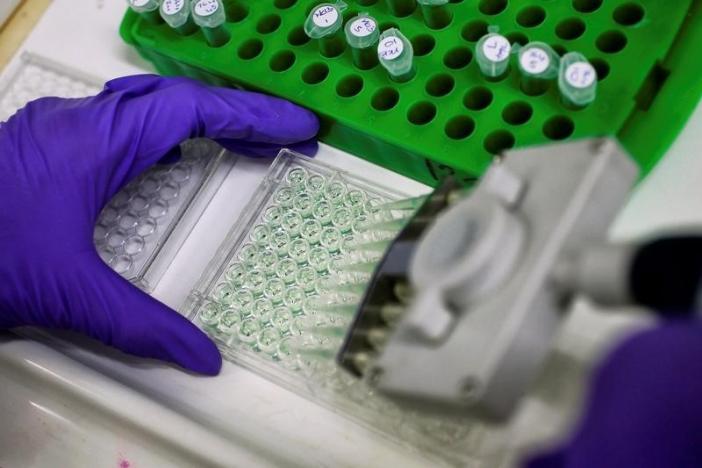 FILE: A scientist prepares protein samples for analysis in a lab at the Institute of Cancer Research in Sutton, Britain, July 15, 2013.       REUTERS