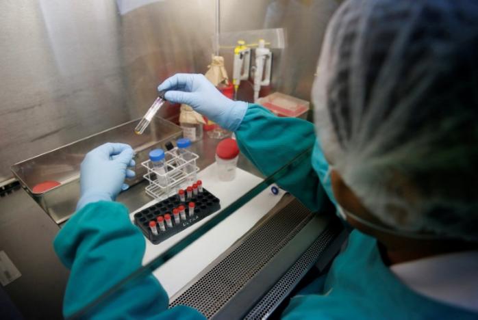 A health technician analyses blood samples for tuberculosis testing in a high-tech tuberculosis lab in Carabayllo in Lima, Peru May 19, 2016. REUTERS/Mariana Bazo