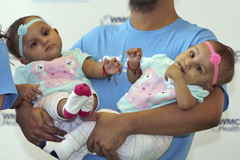 Abel Camacho holds his daughters Bellanie (left) and Ballanie, at Maria Fareri Children's Hospital in Valhalla, New York, on Friday, March 24, 2017. Photo: The Journal News via AP