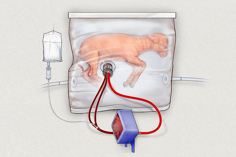 An artists impression shows a lamb inside a fluid-filled womb-like bag known as an extra-uterine support device developed by the Children's Hospital of Philadelphia.Courtesy: Children's Hospital of Philadelphia handout via REUTERS.