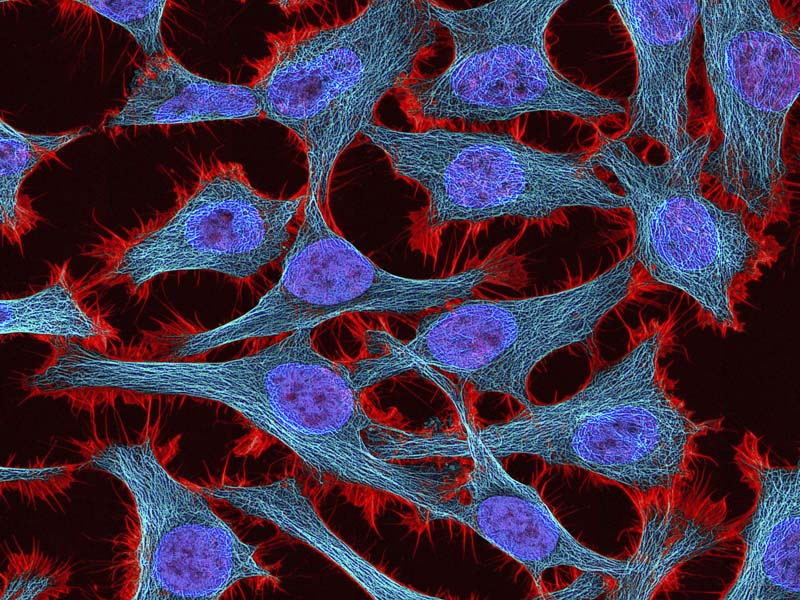 This undated microscope image made available by the National Center for Microscopy and Imaging Research shows HeLa cells. Photo: AP