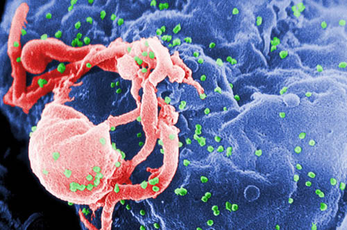 This undated photo provided by the Centers for Disease Control and Prevention shows a scanning electron micrograph of multiple round bumps of the HIV-1 virus on a cell surface. Photo: AP