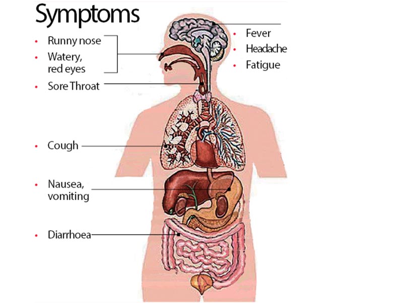 Labelled diagram shows symptoms of swine flu. Graphic: THT