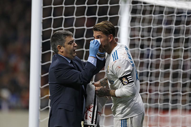 Real Madrid's Sergio Ramos (right), with his jersey stained with blood is cared for by a team's doctor during the Spanish La Liga soccer match between Real Madrid and Atletico at the Wanda Metropolitano stadium in Madrid, Saturday, Nov 18, 2017. Photo: AP