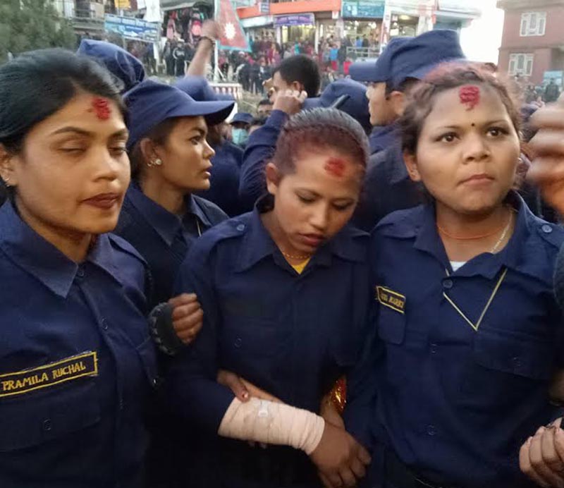 An injured temporary policewoman showing her hand after a clash with Nepal Police at Charikot, in Dolakha, on Monday, December 18, 2017. Temporary police personnel, hired for elections, staged a protest after they did not get their allowance along with other facilities. Photo: THT