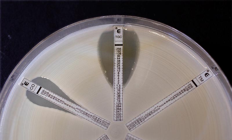 A plate which was coated with an antibiotic-resistant bacteria called Klebsiella with a mutation called NDM 1 and then exposed to various antibiotics is seen at the Health Protection Agency in north London, on March 9, 2011.  Photo: Reuters/ File