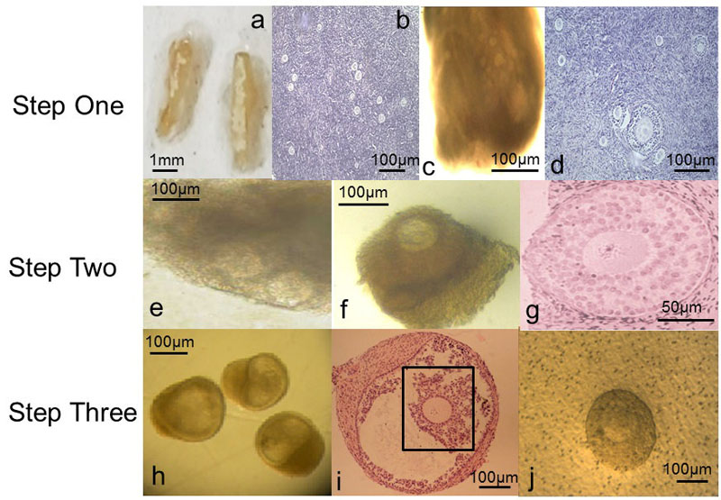 A series of magnified images show human eggs in development stages. Photo: Prof Evelyn Telfer and Dr Marie McLaughlin/University of Edinburgh/Handout via Reuters