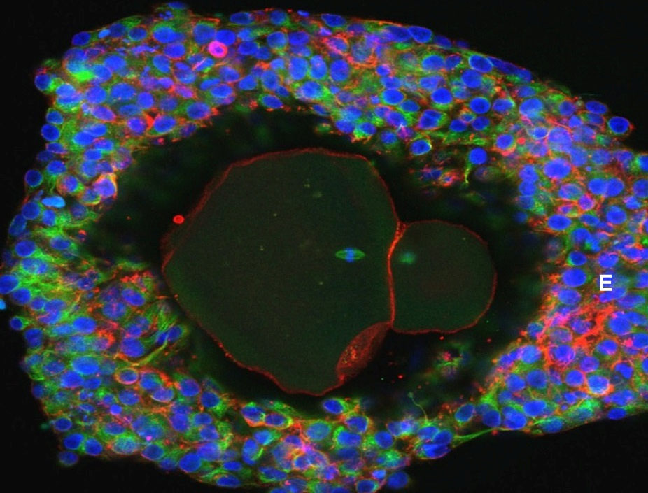 An undated picture shows a magnification of a lab-grown fully matured human egg ready for fertilisation. Photo: Doctor David Albertini/University of Edinburgh/Handout via Reuters