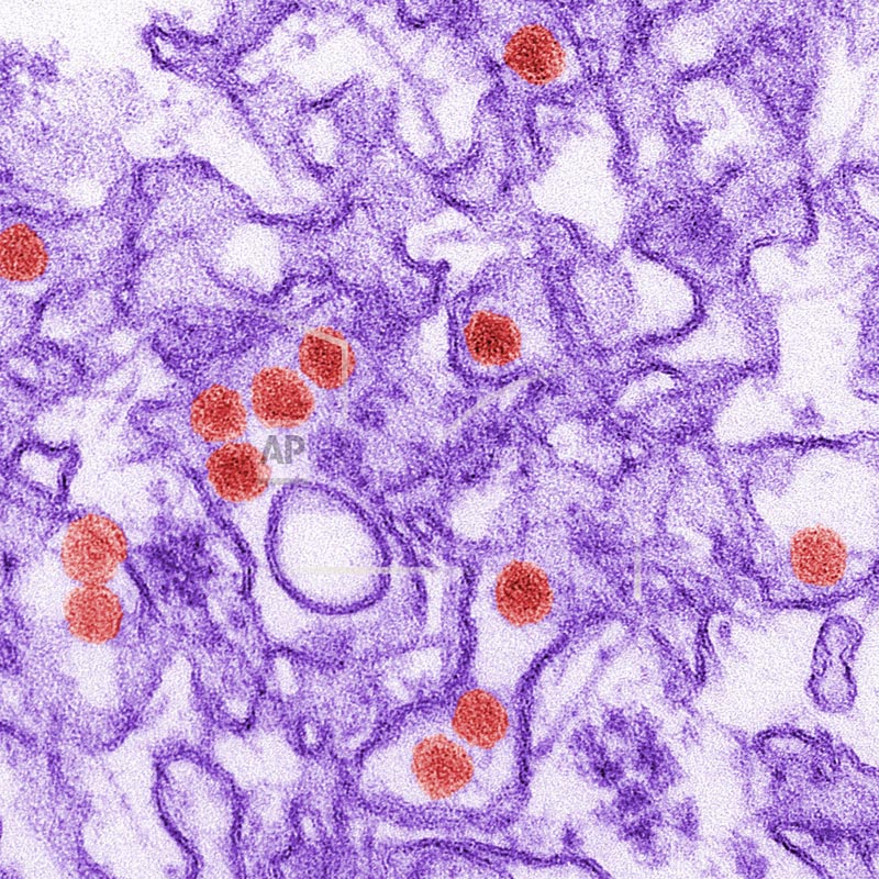 FILE - This 2016 digitally-colorized electron microscope image made available by the Centers for Disease Control and Prevention shows the Zika virus, in red, about 40 nanometers in diameter. Photo: AP
