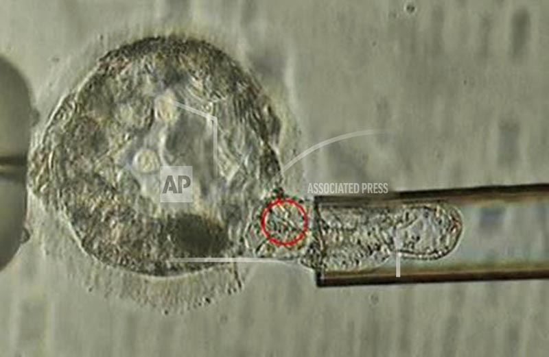 This undated microscope image provided by the American Society for Reproductive Medicine in January 2018 shows a trophectoderm biopsy, in which cells from the outer layer of an embryo that develop into the placenta and amniotic membranes are removed and can be used for genetic testing. Photo: ASRM via AP