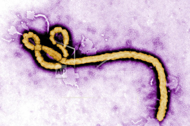 File: This undated colorized transmission electron micrograph image made available by the Centres for Disease Control and Prevention shows an Ebola virion. Photo: AP