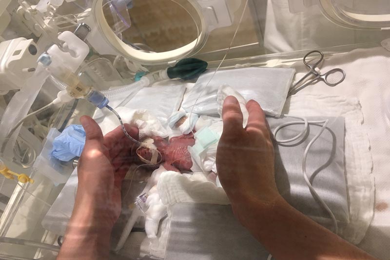 A baby boy weighing 268 grams when born in August 2018, the hospital claims is the smallest baby to survive and be sent home healthy, is seen five days after his birth in Tokyo, Japan, in this undated handout photo released by Keio University School of Medicine, Department of Pediatrics and obtained Reuters on February 27, 2019. Photo: Keio University School of Medicine, Department of Pediatrics/Handout via Reuters