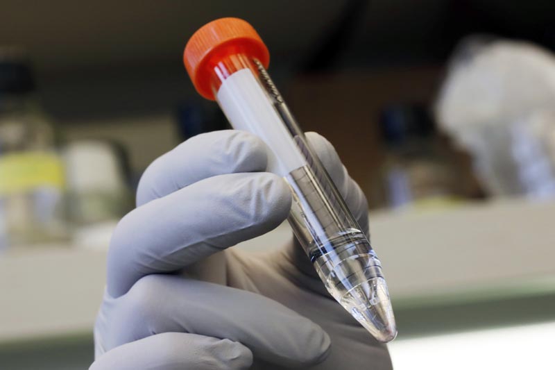 Yale University researcher Benjamin Chan, who studies viruses that attack bacteria, holds bacteriophage treatment for patient Ella Balasa, of Richmond, Virginia, at Osborn Memorial Laboratories, in New Haven, Connecticut, Thursday January 17, 2019.Photo: AP