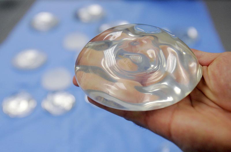 This photo shows a silicone gel breast implant taken in Irving, Texas on December 11, 2006. Photo: AP/File