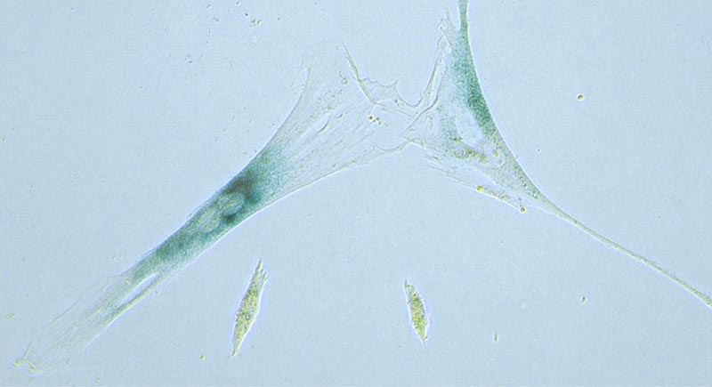 This April 2019 microscope photo provided by the Niedernhofer Lab of the Institute on the Biology of Aging and Metabolism at the University of Minnesota shows shows two senescent human fibroblast cells, above, next to normal ones in Minneapolis, Minnesota. Photo: Matthew Yousefzadeh, Mariah Witt/University of Minnesota via AP