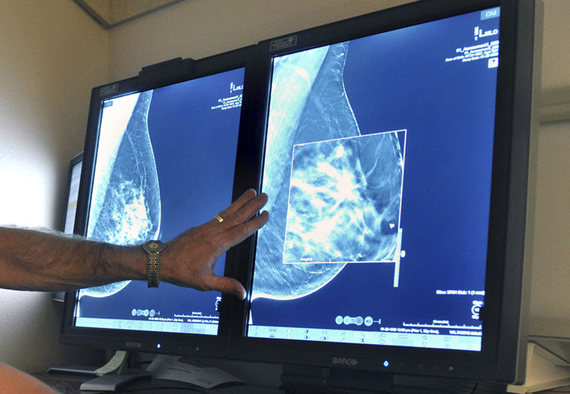 A mammogram, a test to detect cancer, July 31, 2012. Photo: Torin Halsey/Times Record News via AP/File