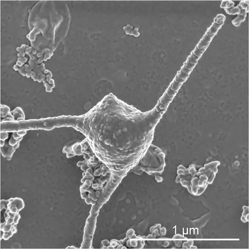 A scanning electron microscopy image of the single-celled organism Prometheoarchaeum syntrophicum strain MK-D1 showing the cell with tentacle-like branching protrusions is seen in this image released at the Japan Agency for Marine-Earth Science and Technology (JAMSTEC) in Yokosuka, Japan, on January 15, 2020. Hiroyuki Imachi, Masaru K Nobu and JAMSTEC/Handout via Reuters