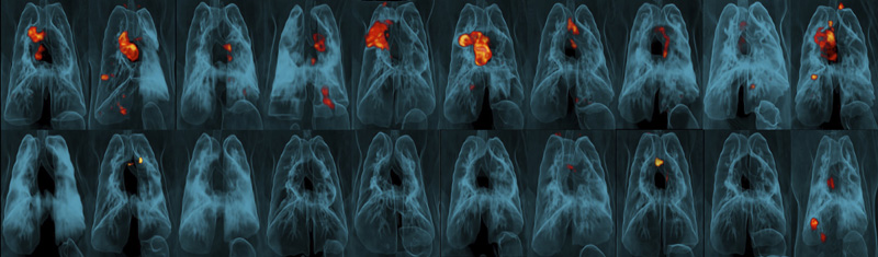 A collection of lung scans of 20 monkeys who were exposed to tuberculosis after receiving different forms of a TB vaccine. Monkeys in the top row received skin-deep shots, and those in the bottom row were given intravenous injections. The intravenous vaccine protected far better, as shown by TB-caused inflammation seen in red and yellow. Photo: JoAnne Flynn, Alexander White and Pauline Maiello/Pitt; Mario Roederer/NIAID via AP
