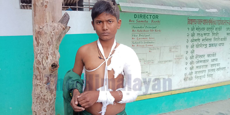 Pictured here is Hritik Yadav, a student of Swastik School, in Mirchaiya Municipality of Siraha district. He was reportedly beaten by his teacher for not doing homework. Photo: Aashish BK/THT
