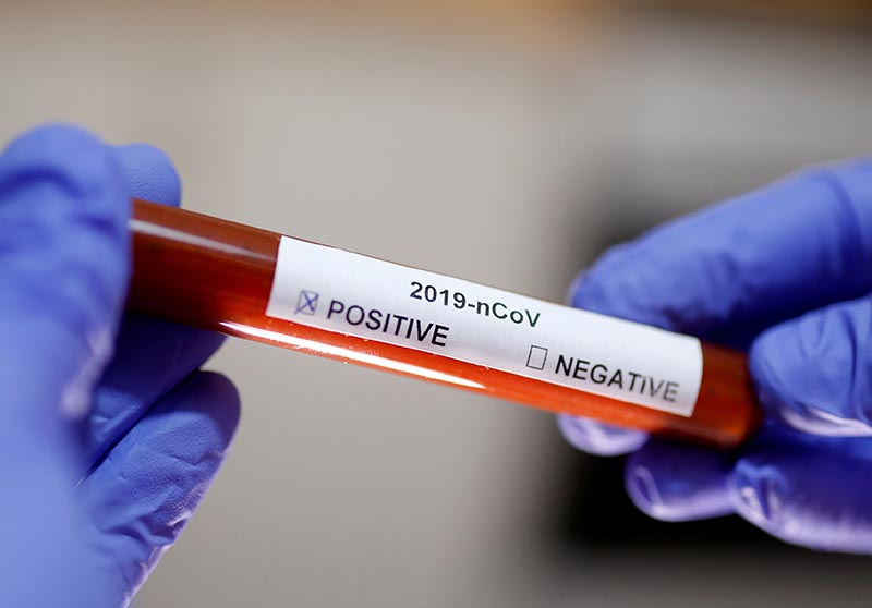 FILE - Test tube with Corona virus name label is seen in this illustration taken on January 29, 2020. Photo: Reuters