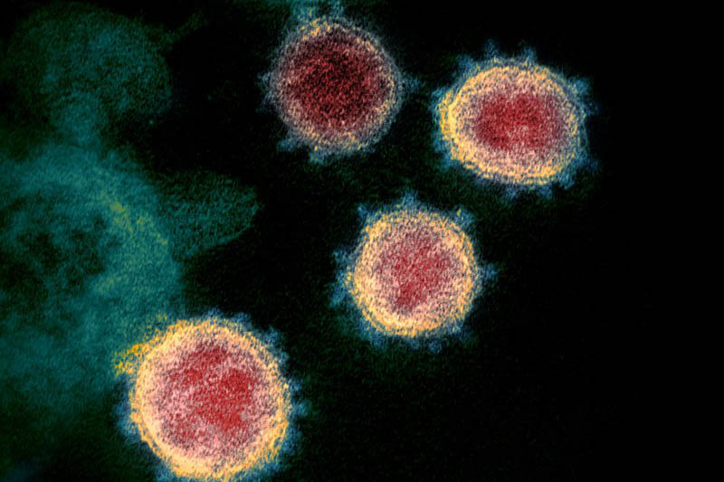 This undated electron microscope image made available by the US National Institutes of Health in February 2020 shows the virus that causes COVID-19. Photo: AP