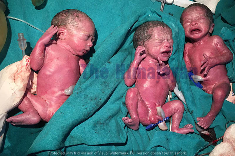 Newly born triplets babies in Pokhara, on Thursday, May 07, 2020. Photo: Bharat Koirala/THT