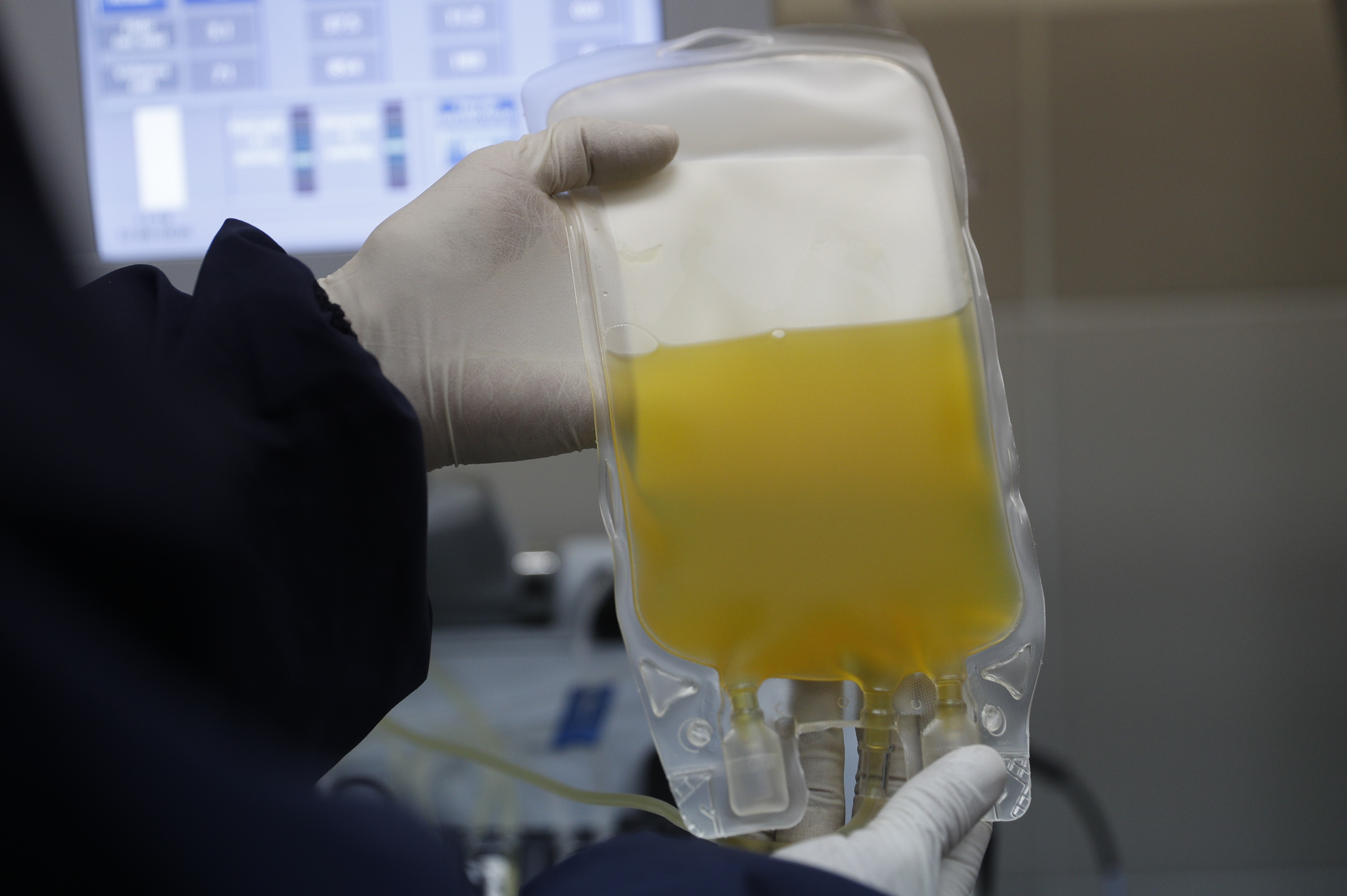 FILE - In this Friday, June 12, 2020 file photo, a doctor holds a bag of blood plasma donated by a COVID-19 survivor at at blood bank in La Paz, Bolivia. Mayo Clinic researchers are reporting a strong hint that blood plasma from COVID-19 survivors helps other patients recover. But it's not proof, and some experts worry if, amid clamor for the treatment, they'll ever get a clear answer. Photo: AP