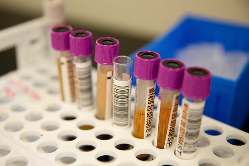 FILE - Convalescent plasma samples in vials are seen before being tested for COVID-19 antibodies at the Bloodworks Northwest Laboratory during the coronavirus disease (COVID-19) outbreak in Renton, Washington, US, on September 9, 2020. Photo: Reuters